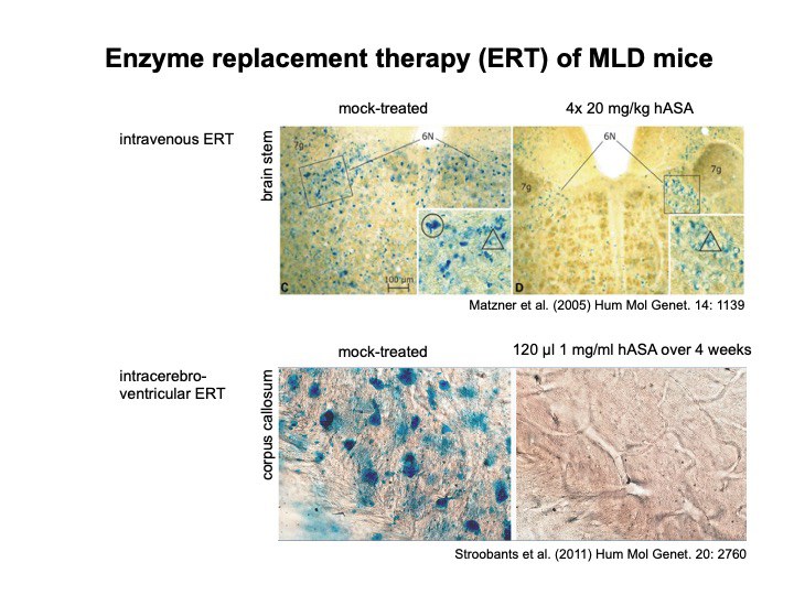 enzyme_replacement_therapy_ert_of_mld_mice.jpeg